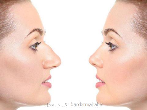 چه كسی برای جراحی بینی مناسب است؟